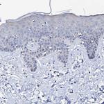 Triadin Antibody in Immunohistochemistry (IHC)