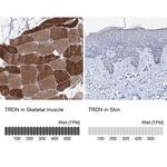 Triadin Antibody