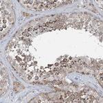 CHCHD5 Antibody in Immunohistochemistry (Paraffin) (IHC (P))