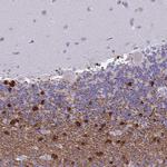 ERMN Antibody in Immunohistochemistry (Paraffin) (IHC (P))