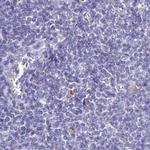 ERMN Antibody in Immunohistochemistry (IHC)