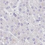 ERMN Antibody in Immunohistochemistry (IHC)