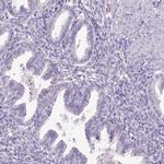 HPD Antibody in Immunohistochemistry (Paraffin) (IHC (P))