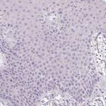 HPD Antibody in Immunohistochemistry (Paraffin) (IHC (P))