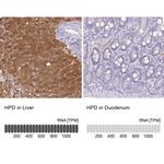 HPD Antibody