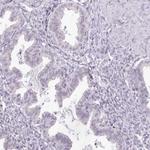 HPD Antibody in Immunohistochemistry (Paraffin) (IHC (P))