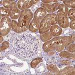 HPD Antibody in Immunohistochemistry (Paraffin) (IHC (P))