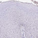 HPD Antibody in Immunohistochemistry (Paraffin) (IHC (P))