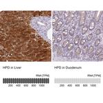 HPD Antibody in Immunohistochemistry (IHC)