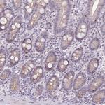 HPD Antibody in Immunohistochemistry (IHC)