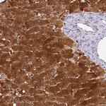 HPD Antibody in Immunohistochemistry (IHC)