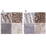 C5orf33 Antibody in Immunohistochemistry (IHC)