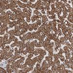 C5orf33 Antibody in Immunohistochemistry (IHC)