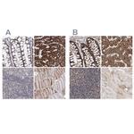 C5orf33 Antibody in Immunohistochemistry (IHC)