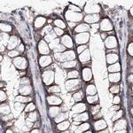 C5orf33 Antibody in Immunohistochemistry (IHC)