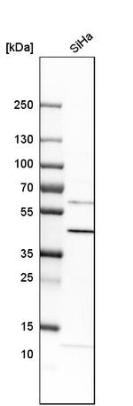 C5orf33 Antibody in Western Blot (WB)