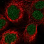 SynGAP Antibody in Immunocytochemistry (ICC/IF)