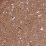 SynGAP Antibody in Immunohistochemistry (IHC)