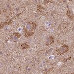 SynGAP Antibody in Immunohistochemistry (IHC)