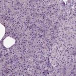 SynGAP Antibody in Immunohistochemistry (IHC)