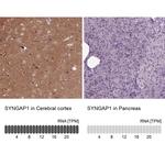 SynGAP Antibody