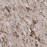 SynGAP Antibody in Immunohistochemistry (IHC)