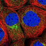 CPEB4 Antibody in Immunocytochemistry (ICC/IF)