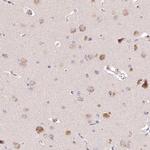 PCYOX1L Antibody in Immunohistochemistry (Paraffin) (IHC (P))