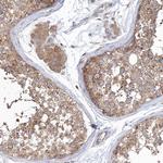 SEC23IP Antibody in Immunohistochemistry (Paraffin) (IHC (P))