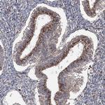 WDR48 Antibody in Immunohistochemistry (IHC)