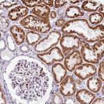 PPIP5K2 Antibody in Immunohistochemistry (Paraffin) (IHC (P))