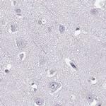 BFSP2 Antibody in Immunohistochemistry (IHC)