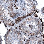 ME3 Antibody in Immunohistochemistry (IHC)