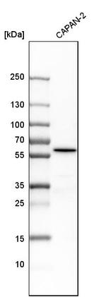 ME3 Antibody in Western Blot (WB)