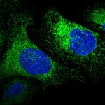 RCN1 Antibody in Immunocytochemistry (ICC/IF)