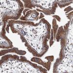 RCN1 Antibody in Immunohistochemistry (IHC)