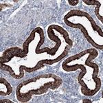 RCN1 Antibody in Immunohistochemistry (IHC)