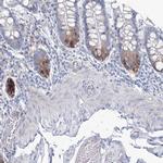 RCN1 Antibody in Immunohistochemistry (IHC)