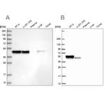 RCN1 Antibody in Western Blot (WB)