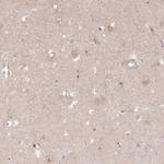 HAL Antibody in Immunohistochemistry (IHC)