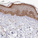 HAL Antibody in Immunohistochemistry (IHC)