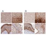 HAL Antibody in Immunohistochemistry (IHC)