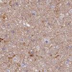 HAL Antibody in Immunohistochemistry (IHC)