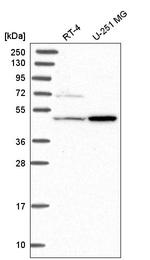 HAL Antibody in Western Blot (WB)