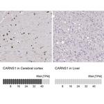 ATPGD1 Antibody in Immunohistochemistry (IHC)