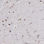 ATPGD1 Antibody in Immunohistochemistry (IHC)