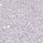 ATPGD1 Antibody in Immunohistochemistry (IHC)