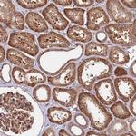 NEDD1 Antibody in Immunohistochemistry (Paraffin) (IHC (P))