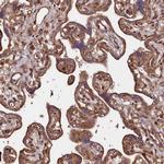 NEDD1 Antibody in Immunohistochemistry (Paraffin) (IHC (P))