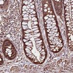 NEDD1 Antibody in Immunohistochemistry (Paraffin) (IHC (P))